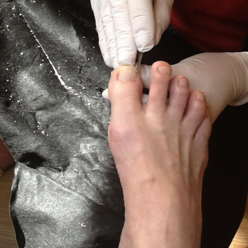 Fodbehandling i klinik i Ullerslev