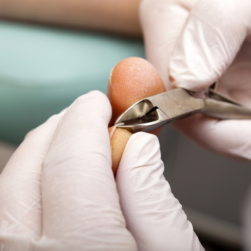 Fodbehandling i Ullerslev, nær Nyborg og Langeskov